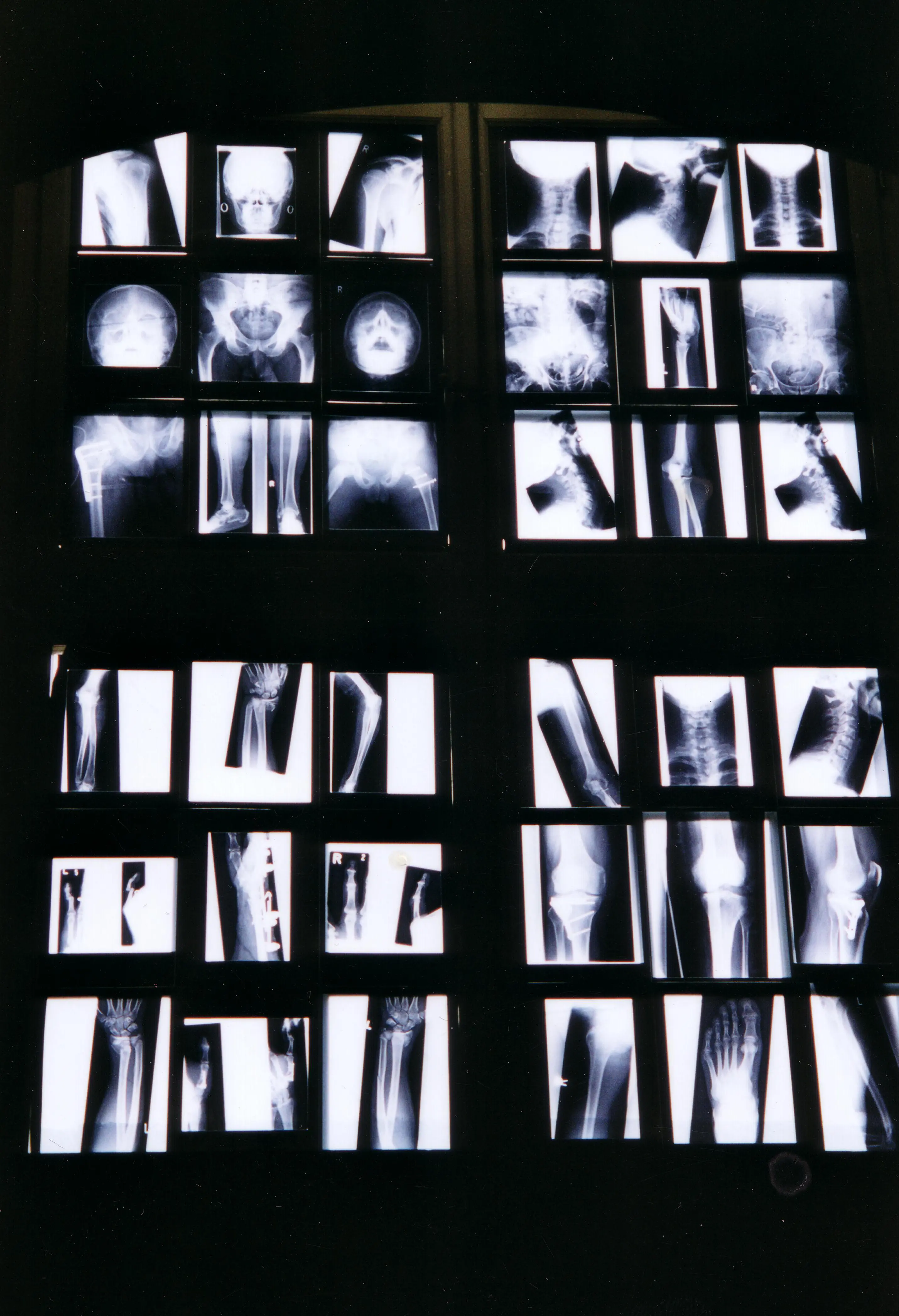 Subcutan I, Marion Linke, 2003/2004