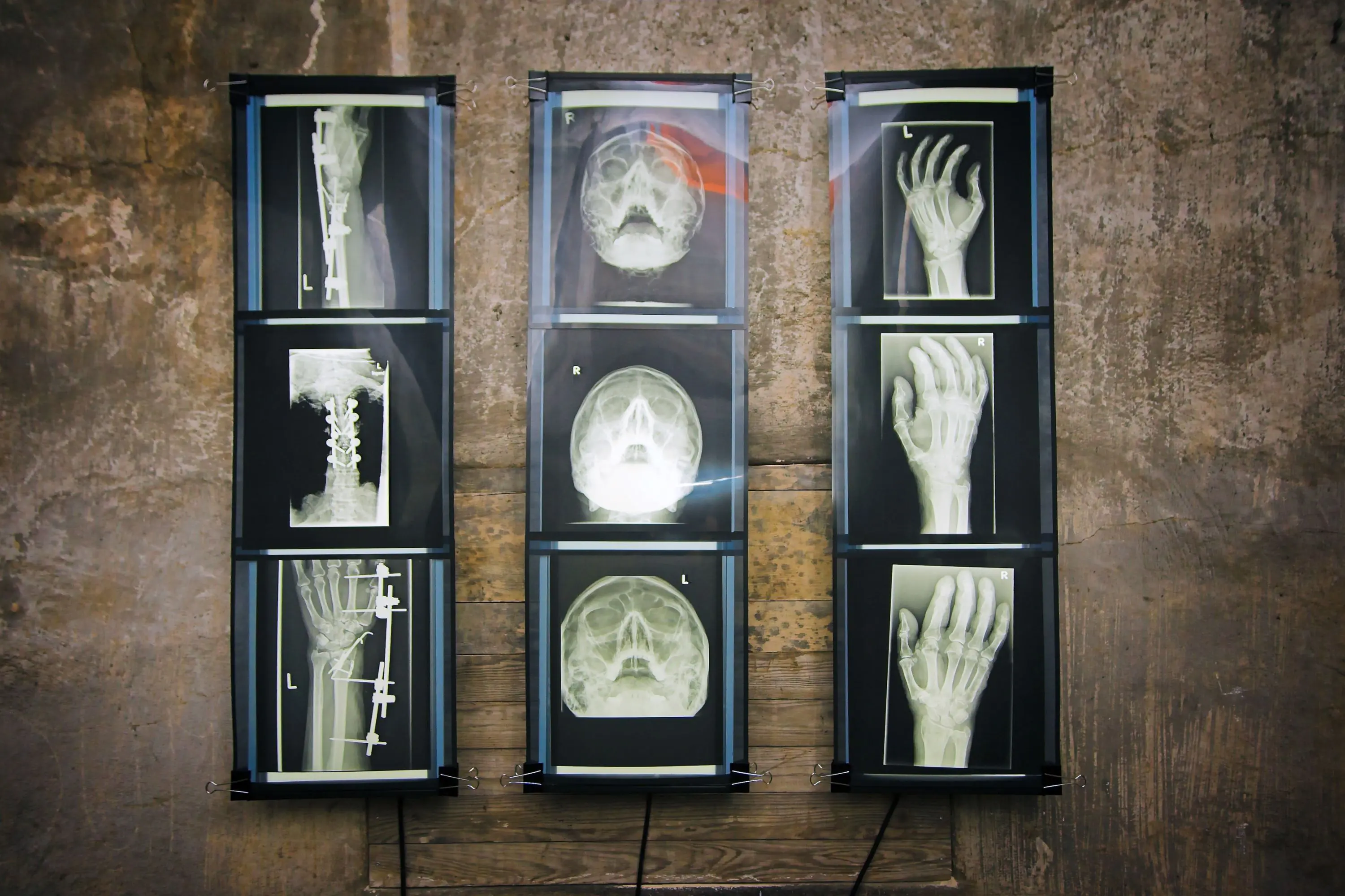 Subcutan II, Marion Linke, 2007